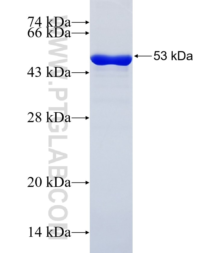 IL-1F7/IL-37 fusion protein Ag21988 SDS-PAGE