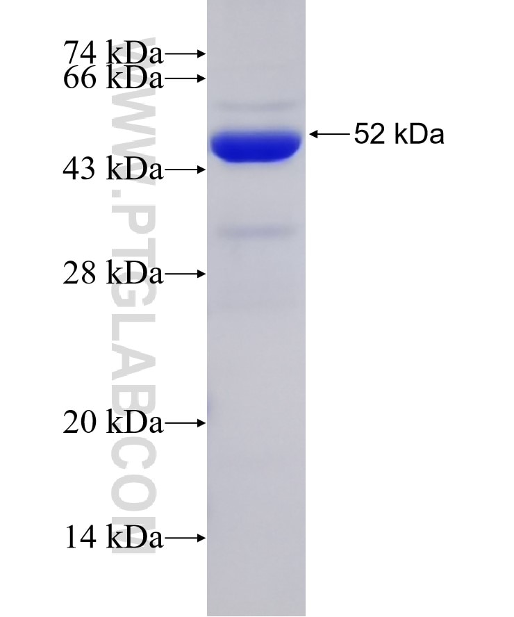 IL-1F7/IL-37 fusion protein Ag2441 SDS-PAGE