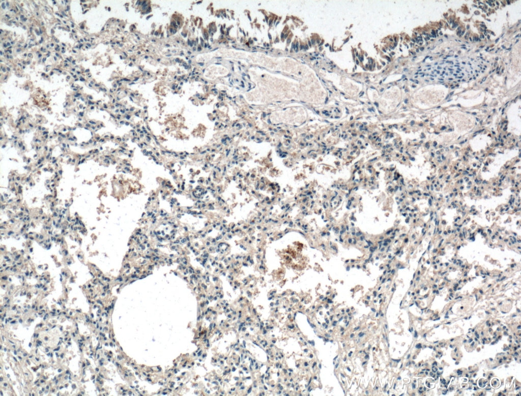 Immunohistochemistry (IHC) staining of human lung tissue using IL-36 Beta/IL-1F8 Polyclonal antibody (18043-1-AP)