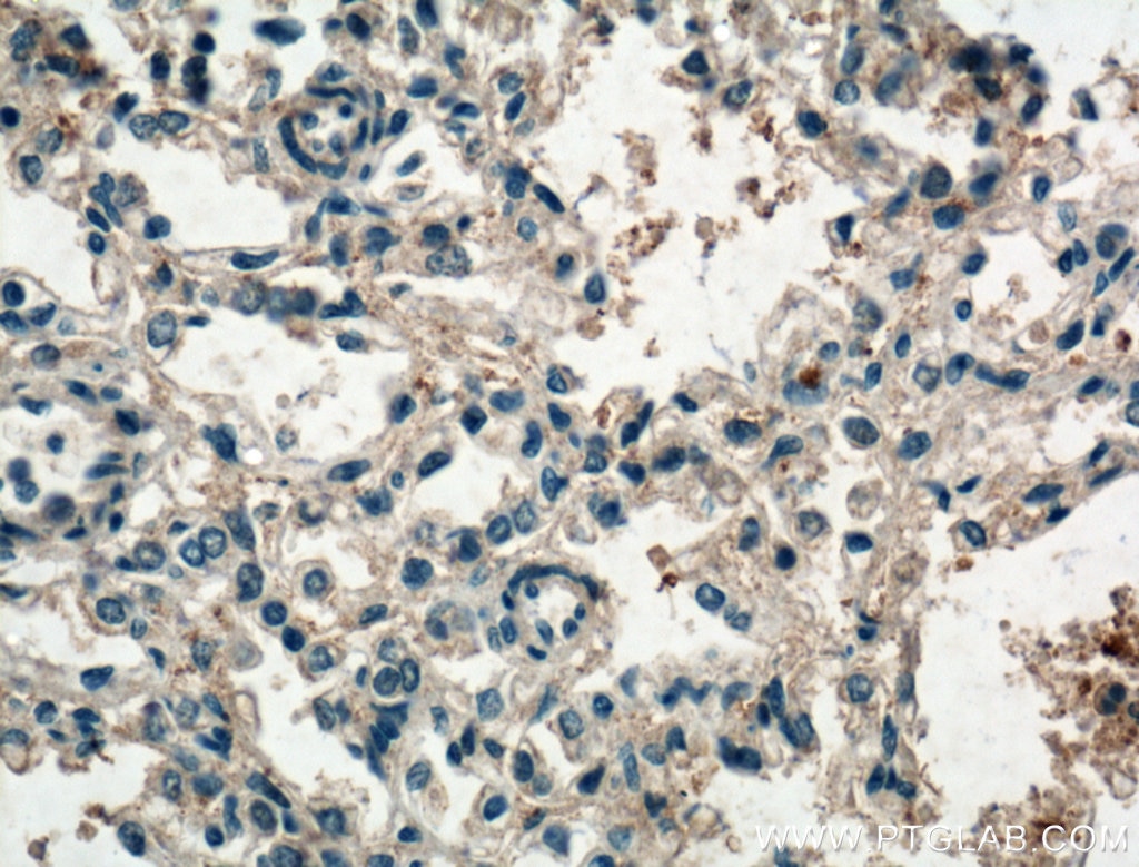 Immunohistochemistry (IHC) staining of human lung tissue using IL-36 Beta/IL-1F8 Polyclonal antibody (18043-1-AP)