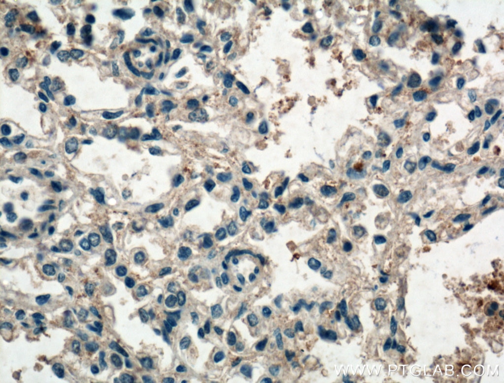 IHC staining of human lung using 18043-1-AP