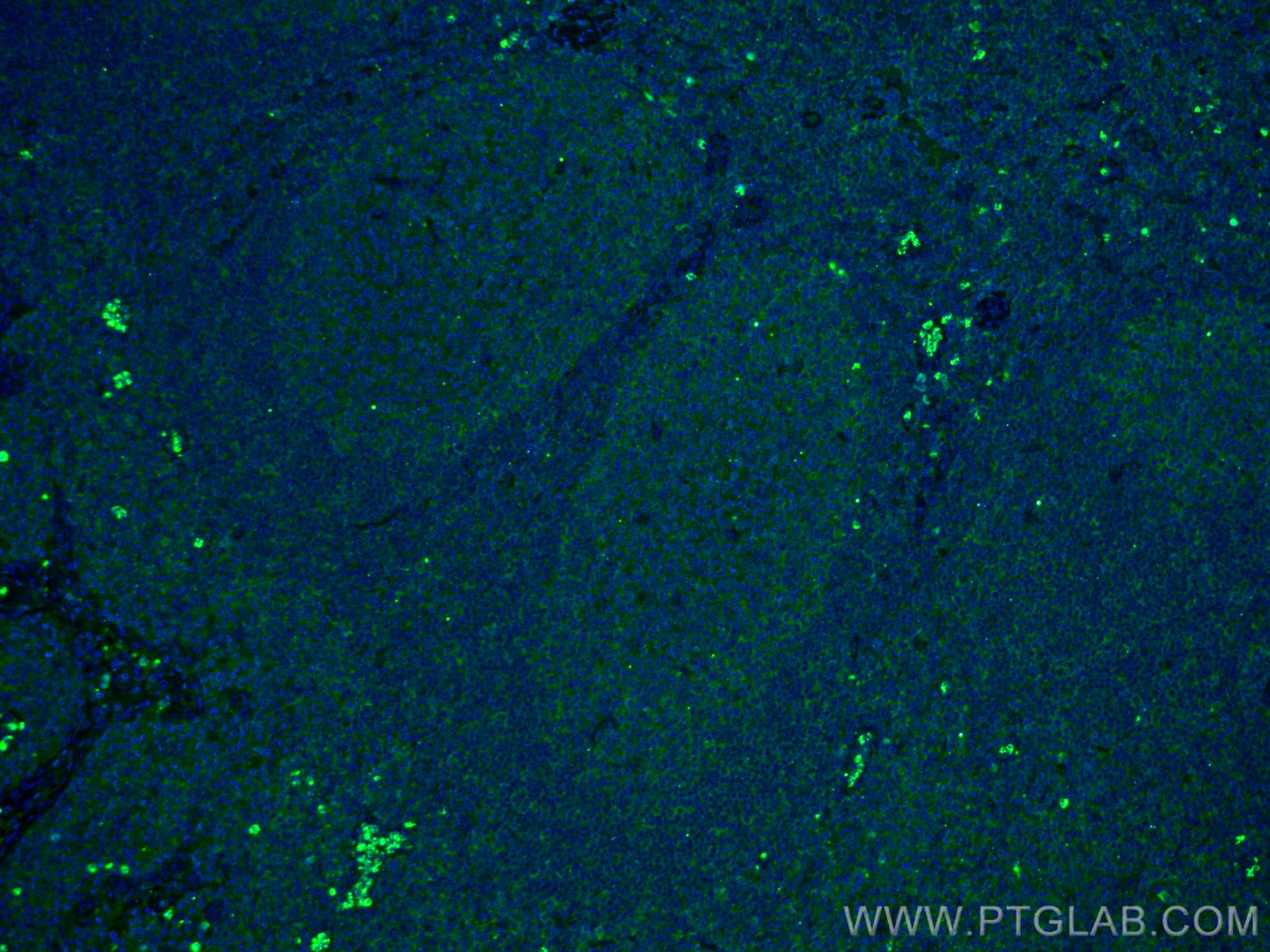 Immunofluorescence (IF) / fluorescent staining of human tonsillitis tissue using IL-36 Beta/IL-1F8 Monoclonal antibody (60290-1-Ig)