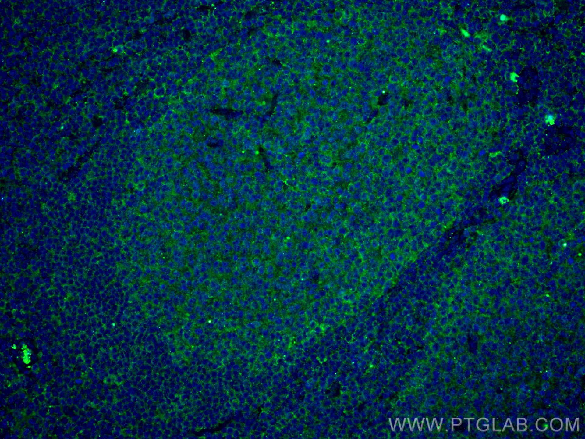 Immunofluorescence (IF) / fluorescent staining of human tonsillitis tissue using IL-36 Beta/IL-1F8 Monoclonal antibody (60290-1-Ig)