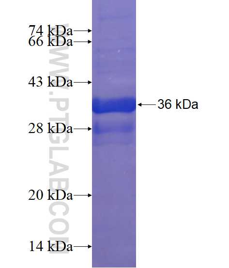 IL-1F9/IL-36 gamma fusion protein Ag15804 SDS-PAGE