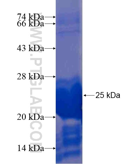 IL-1F9 fusion protein Ag21489 SDS-PAGE