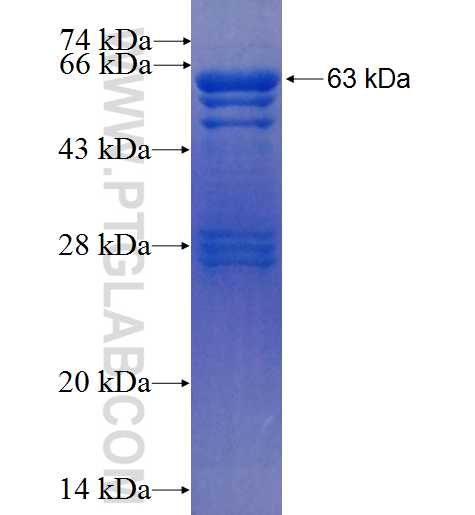 IL-1R1 fusion protein Ag25998 SDS-PAGE