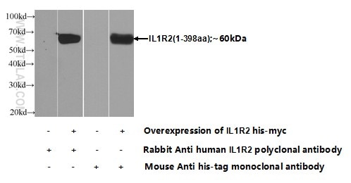 IL-1R2 Polyclonal antibody