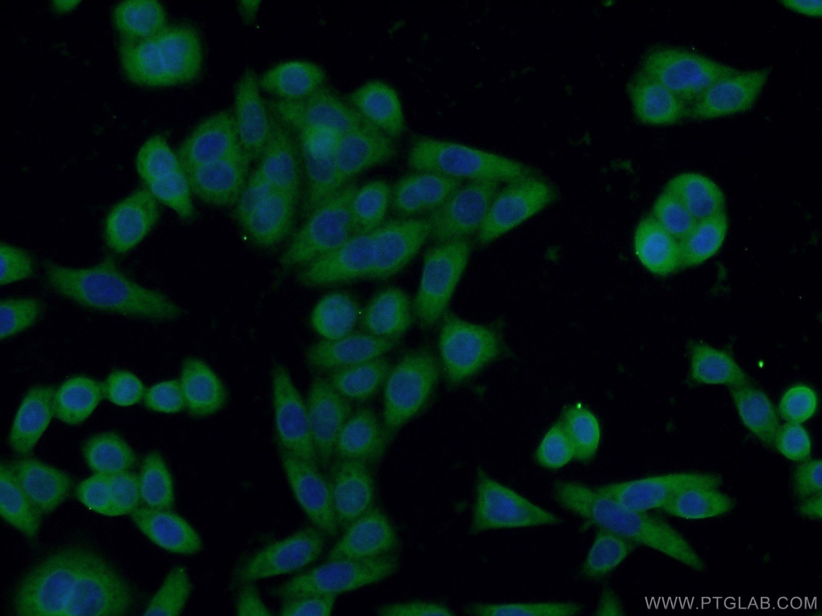 Immunofluorescence (IF) / fluorescent staining of HeLa cells using IL-1R2 Monoclonal antibody (60262-1-Ig)