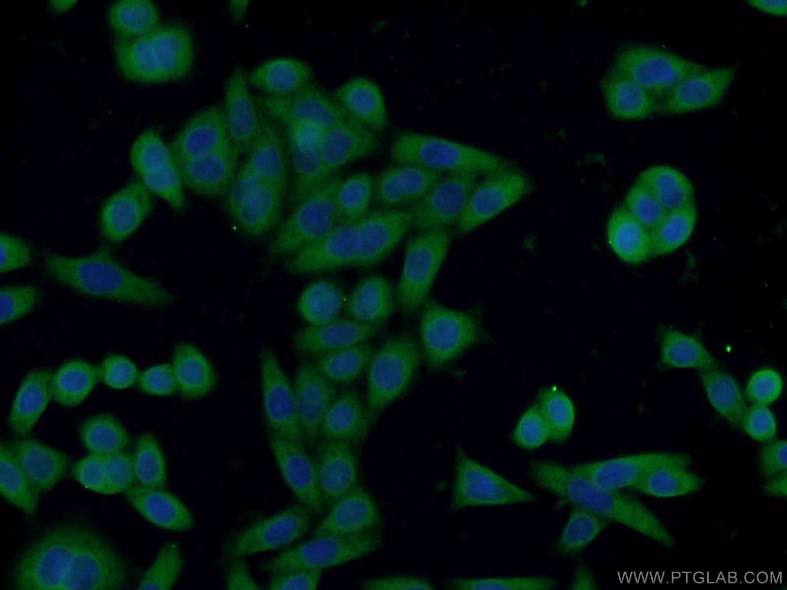 IF Staining of HeLa using 60262-1-Ig