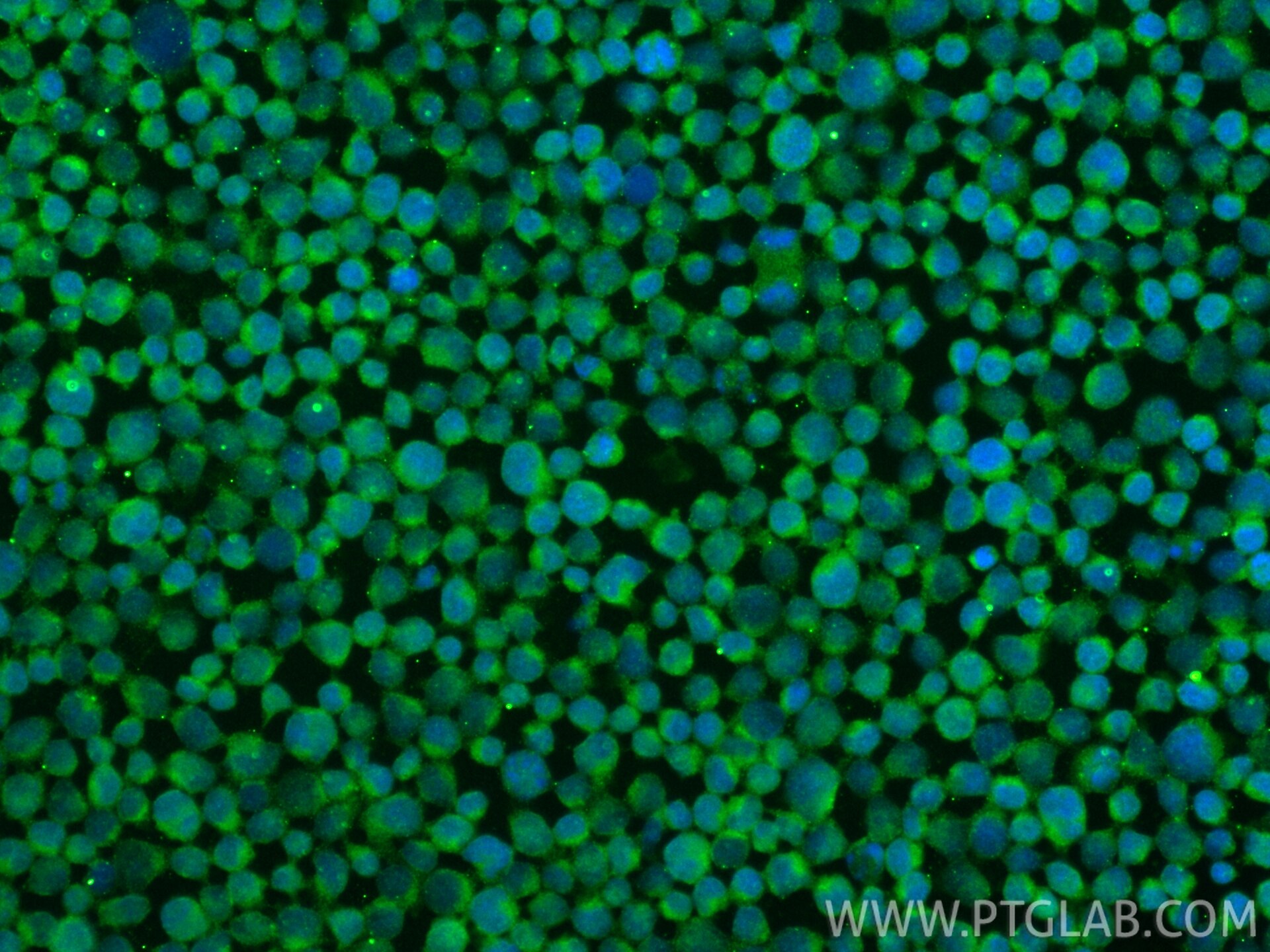 Immunofluorescence (IF) / fluorescent staining of Jurkat cells using IL-1R2 Monoclonal antibody (60262-1-Ig)