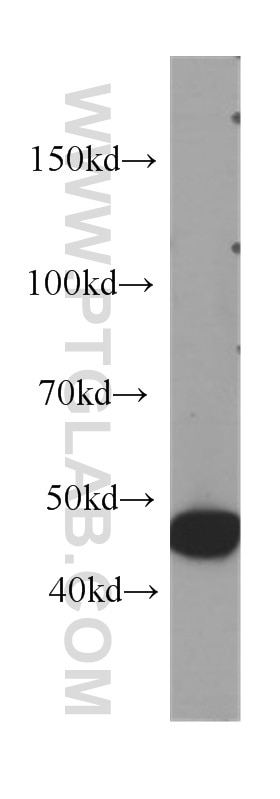 Western Blot (WB) analysis of HeLa cells using IL-1R2 Monoclonal antibody (60262-1-Ig)