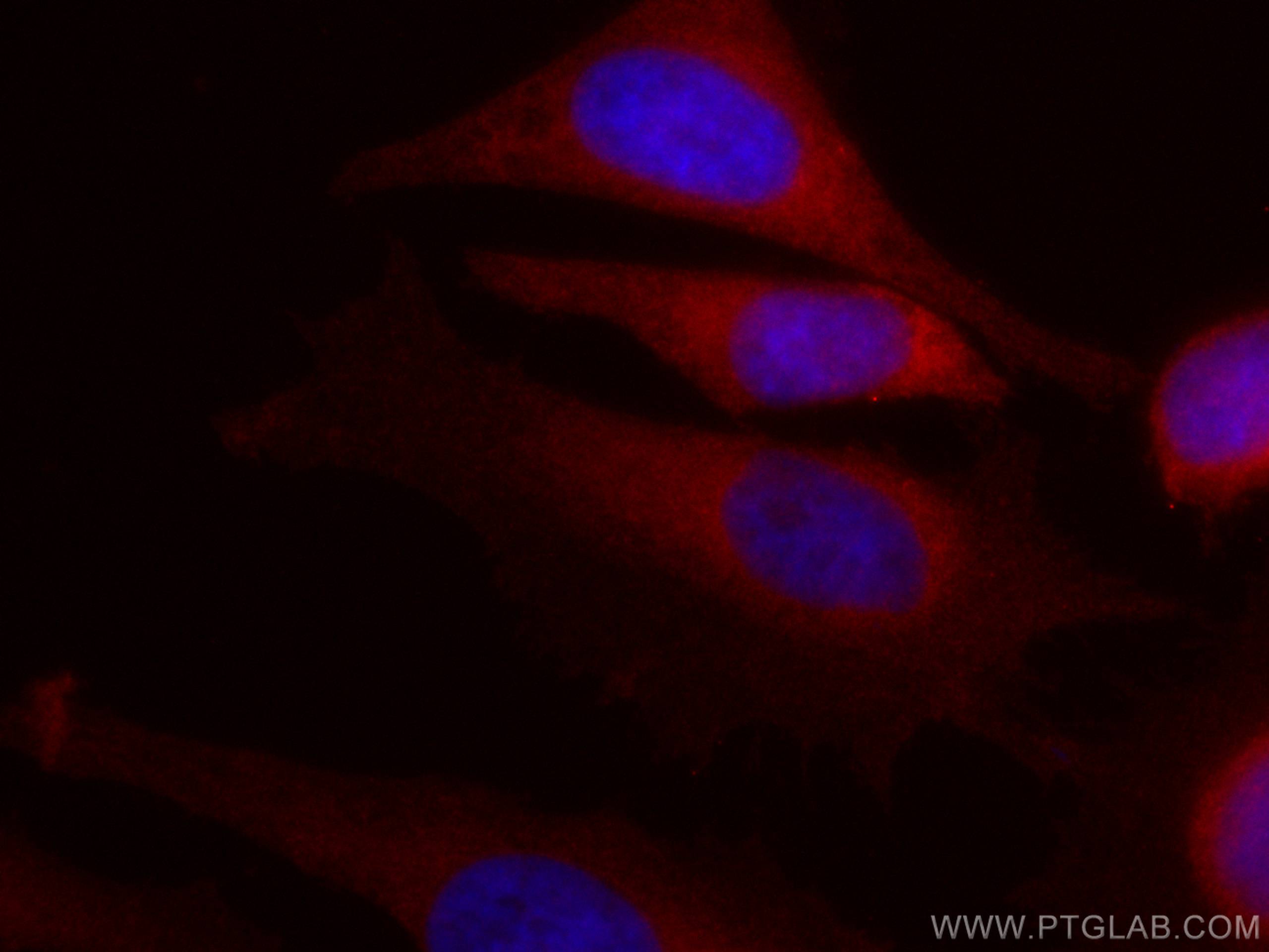 Immunofluorescence (IF) / fluorescent staining of HeLa cells using CoraLite®594-conjugated IL-1R2 Monoclonal antibody (CL594-60262)