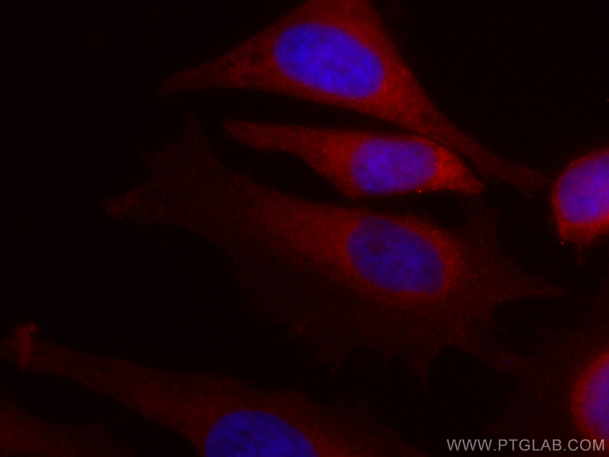 IF Staining of HeLa using CL594-60262