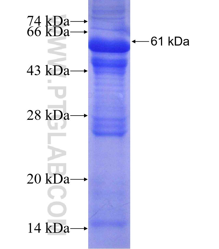 IL-1R2 fusion protein Ag4495 SDS-PAGE