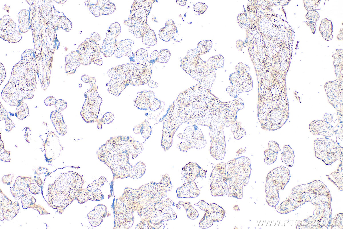Immunohistochemistry (IHC) staining of human placenta tissue using IL-1RAP Polyclonal antibody (30966-1-AP)