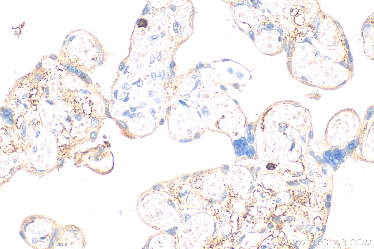 Immunohistochemistry (IHC) staining of human placenta tissue using IL-1RAP Polyclonal antibody (30966-1-AP)