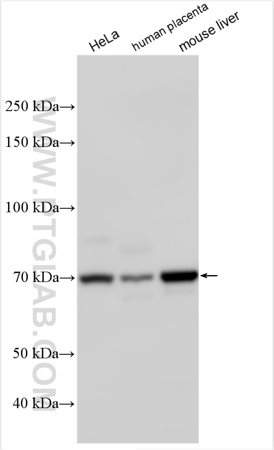 Western Blot (WB) analysis of various lysates using IL-1RAP Polyclonal antibody (30966-1-AP)