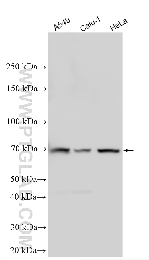 Western Blot (WB) analysis of various lysates using IL-1RAP Polyclonal antibody (30966-1-AP)
