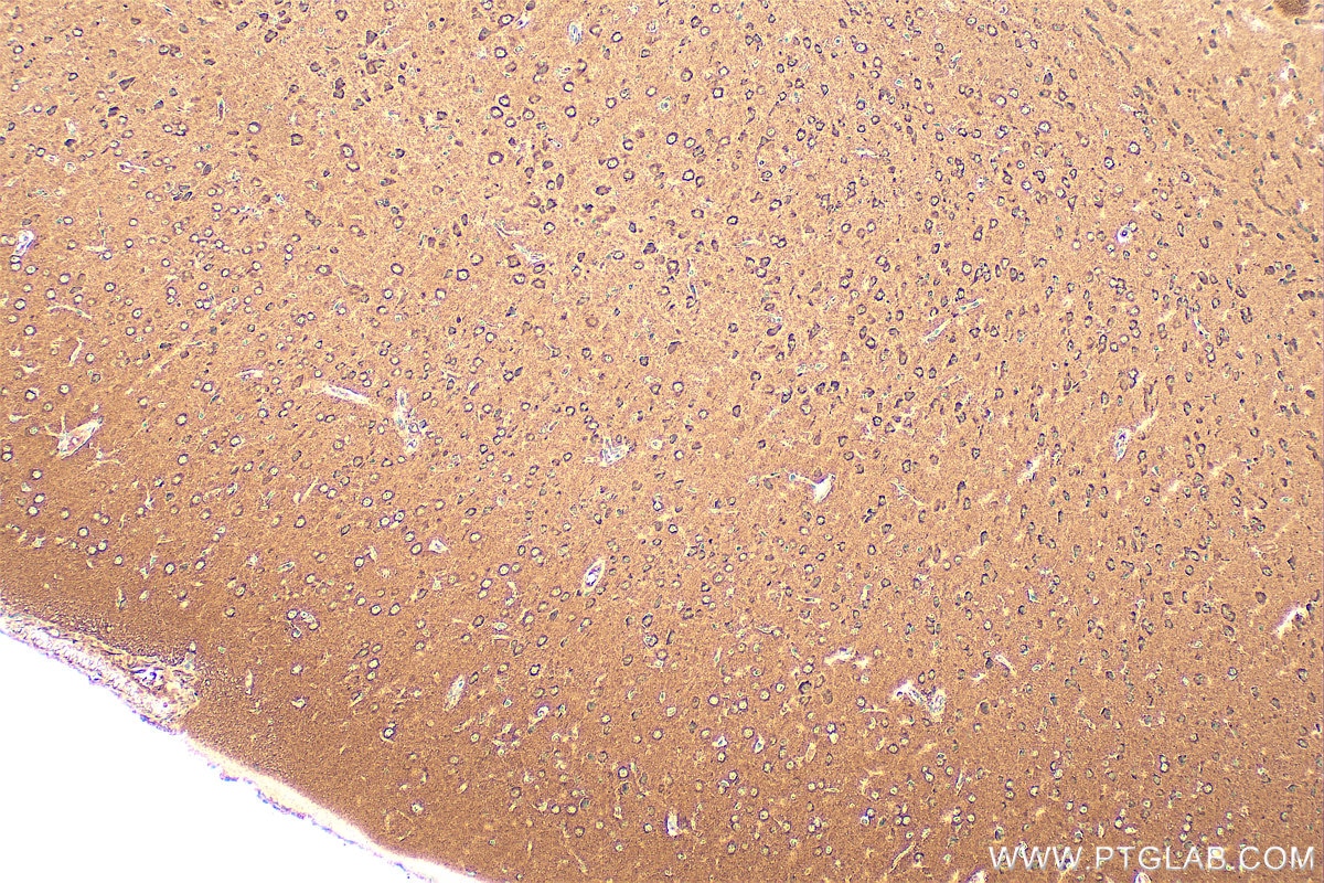 Immunohistochemistry (IHC) staining of mouse brain tissue using IL-1-RAPL-1 Polyclonal antibody (21609-1-AP)