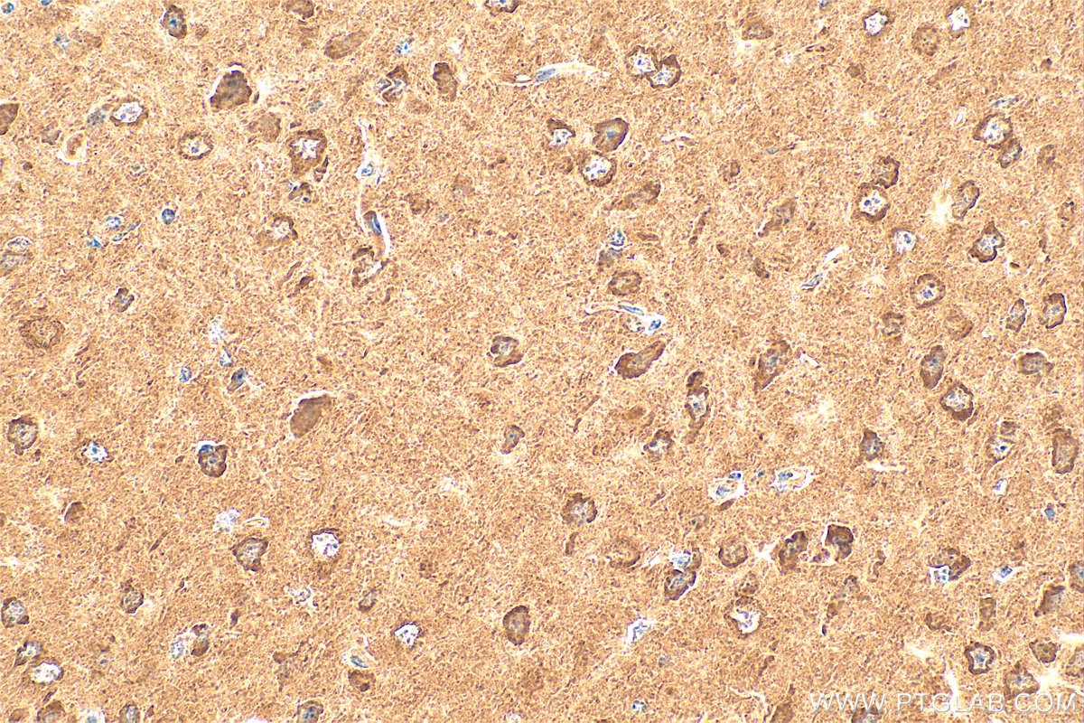 Immunohistochemistry (IHC) staining of mouse brain tissue using IL-1-RAPL-1 Polyclonal antibody (21609-1-AP)