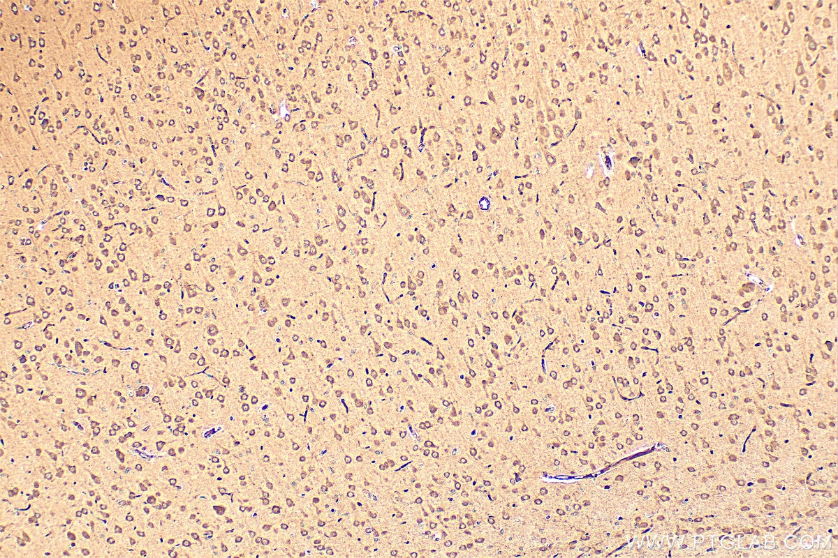 Immunohistochemistry (IHC) staining of rat brain tissue using IL-1-RAPL-1 Polyclonal antibody (21609-1-AP)