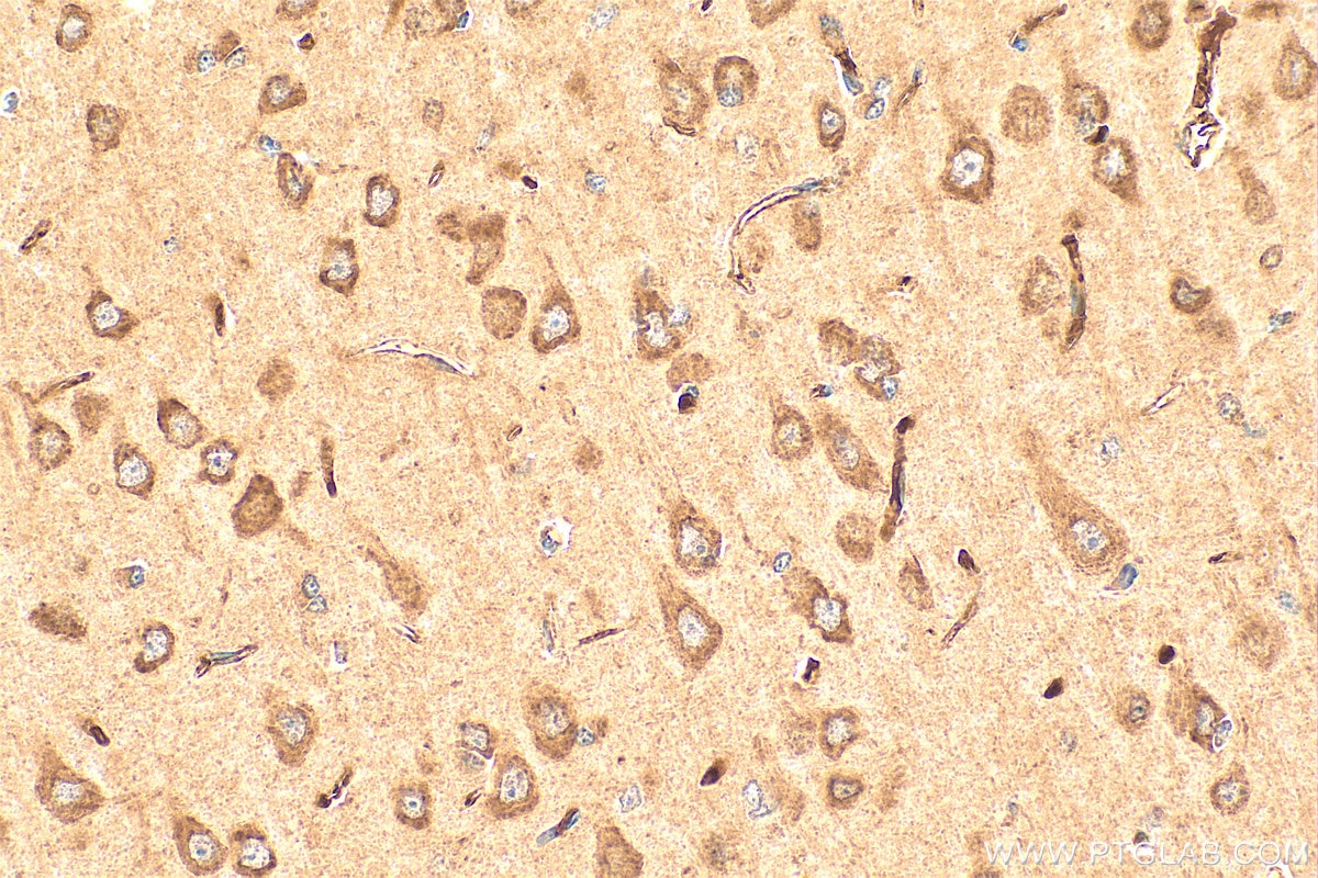 Immunohistochemistry (IHC) staining of rat brain tissue using IL-1-RAPL-1 Polyclonal antibody (21609-1-AP)