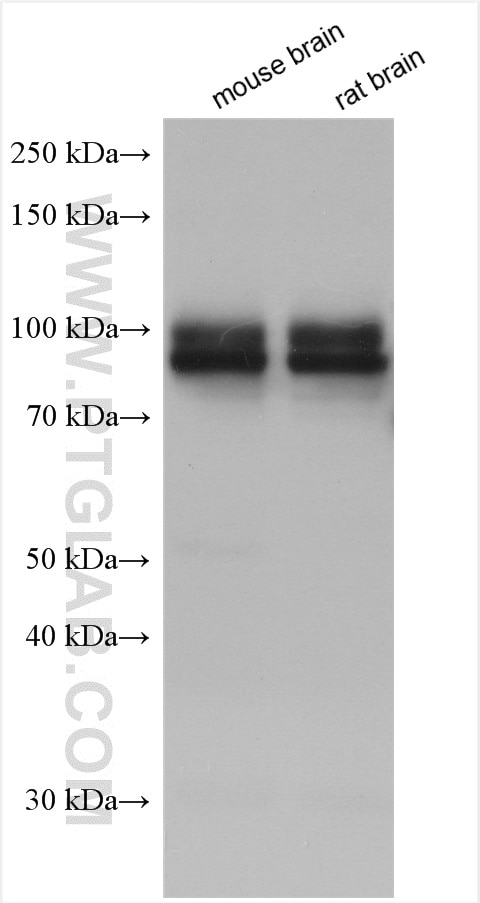 Western Blot (WB) analysis of various lysates using IL-1-RAPL-1 Polyclonal antibody (21609-1-AP)