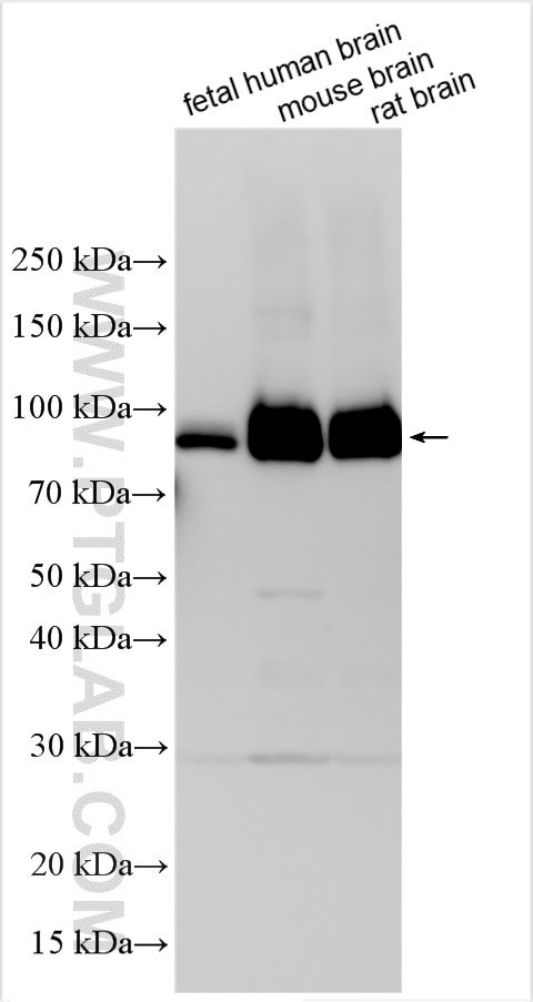 Western Blot (WB) analysis of various lysates using IL-1-RAPL-1 Polyclonal antibody (21609-1-AP)