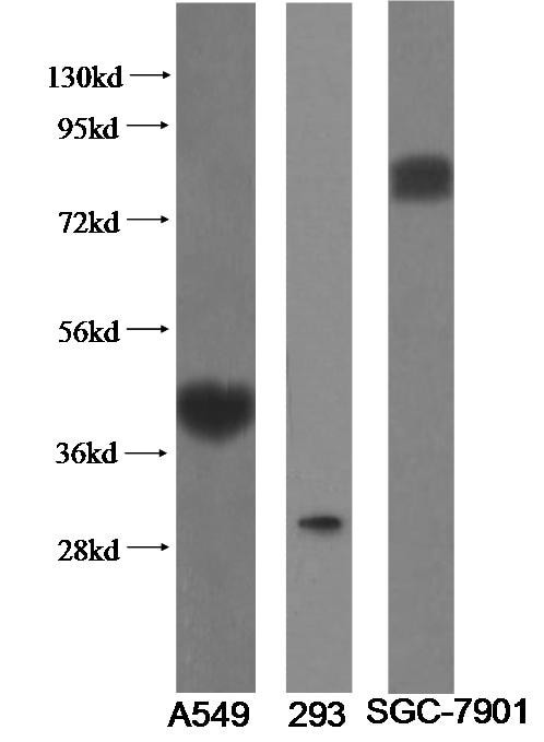 ST2 Polyclonal antibody