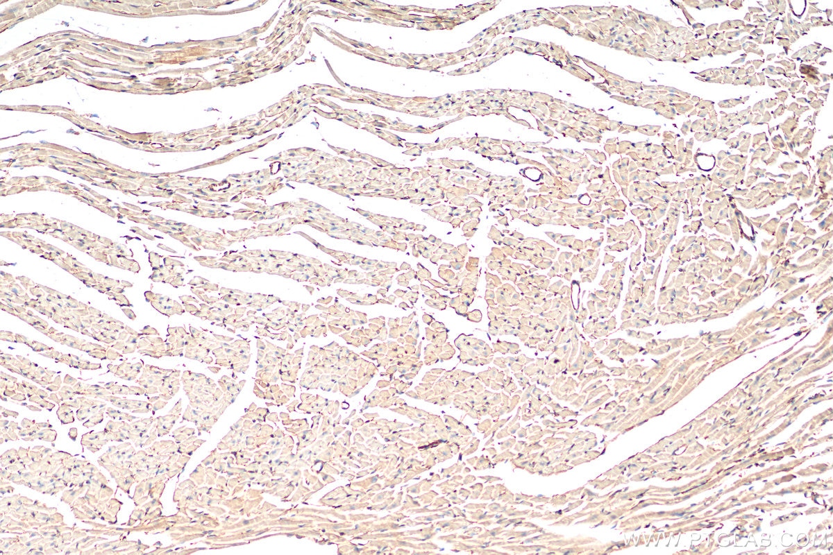 Immunohistochemistry (IHC) staining of mouse heart tissue using ST2 Polyclonal antibody (11920-1-AP)
