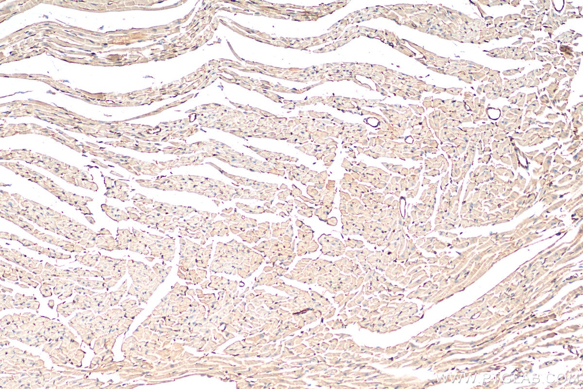 IHC staining of mouse heart using 11920-1-AP