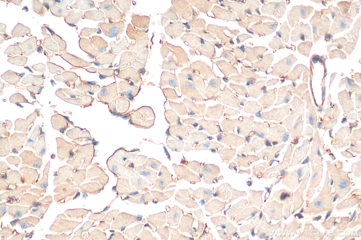Immunohistochemistry (IHC) staining of mouse heart tissue using ST2 Polyclonal antibody (11920-1-AP)