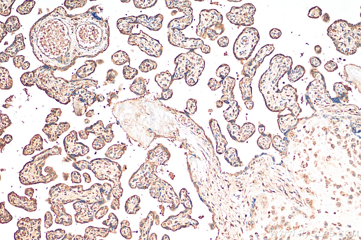 Immunohistochemistry (IHC) staining of human placenta tissue using ST2 Polyclonal antibody (11920-1-AP)