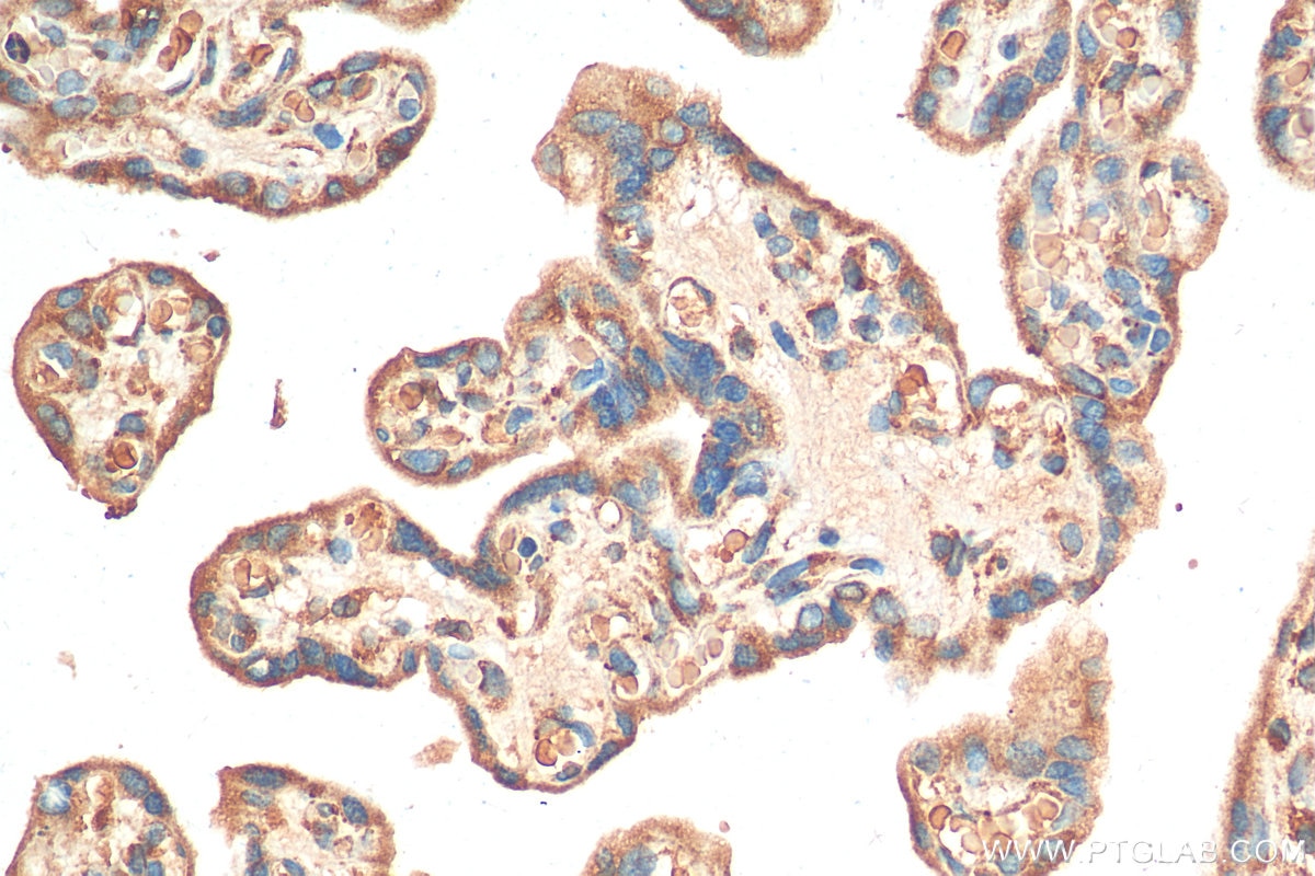 Immunohistochemistry (IHC) staining of human placenta tissue using ST2 Polyclonal antibody (11920-1-AP)