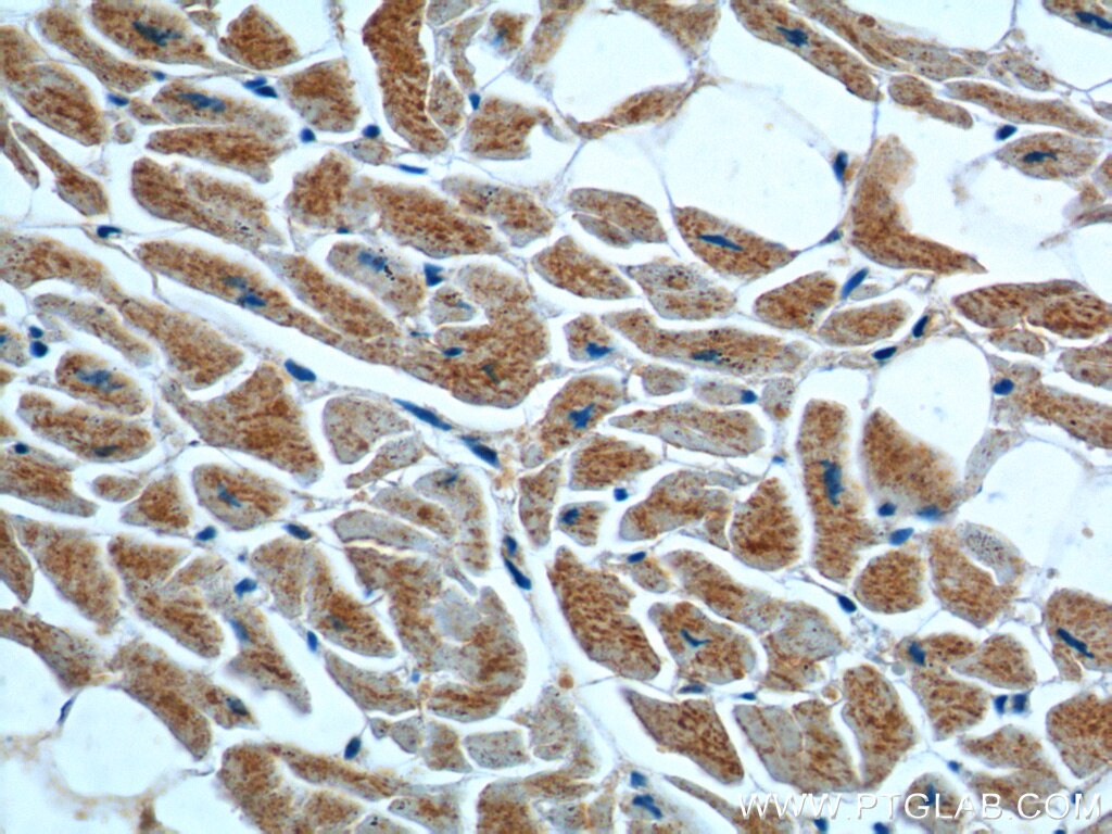 IHC staining of human heart using 11920-1-AP