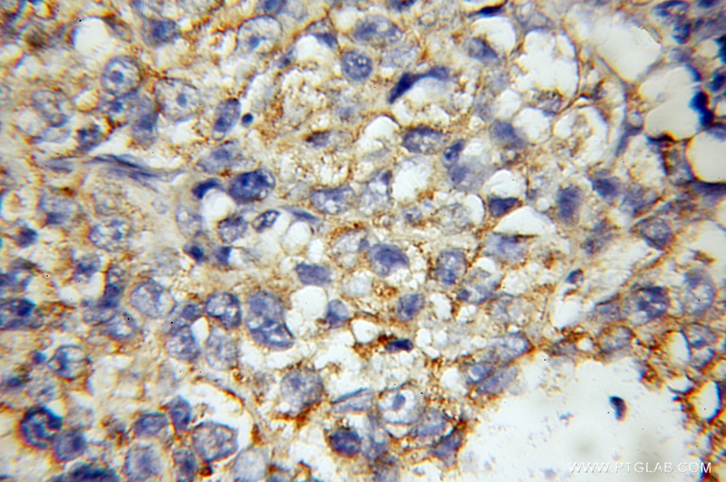 ST2 Polyclonal antibody