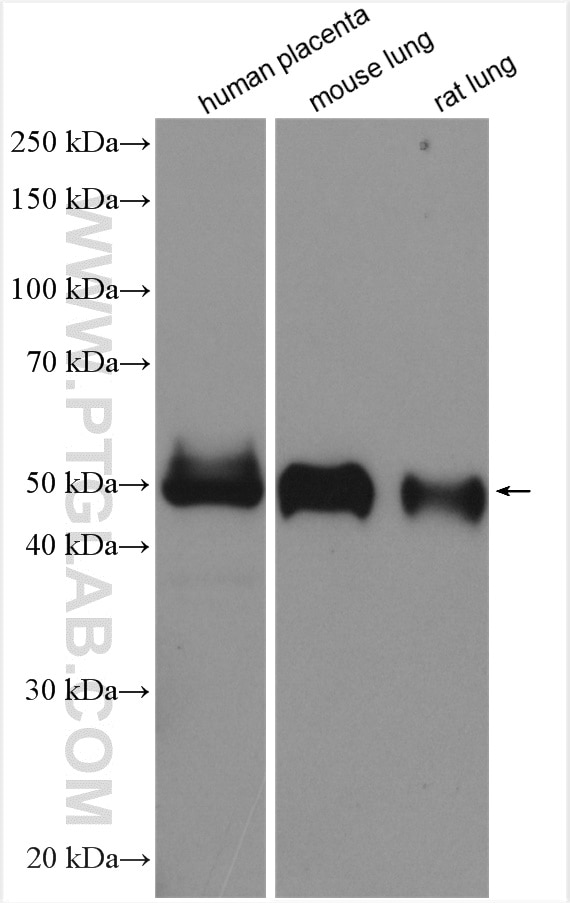 Western Blot (WB) analysis of various lysates using ST2 Polyclonal antibody (11920-1-AP)
