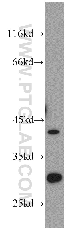 ST2 Polyclonal antibody