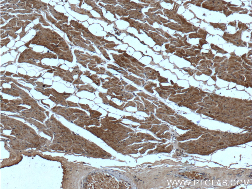 Immunohistochemistry (IHC) staining of human heart tissue using ST2 Monoclonal antibody (60112-1-Ig)