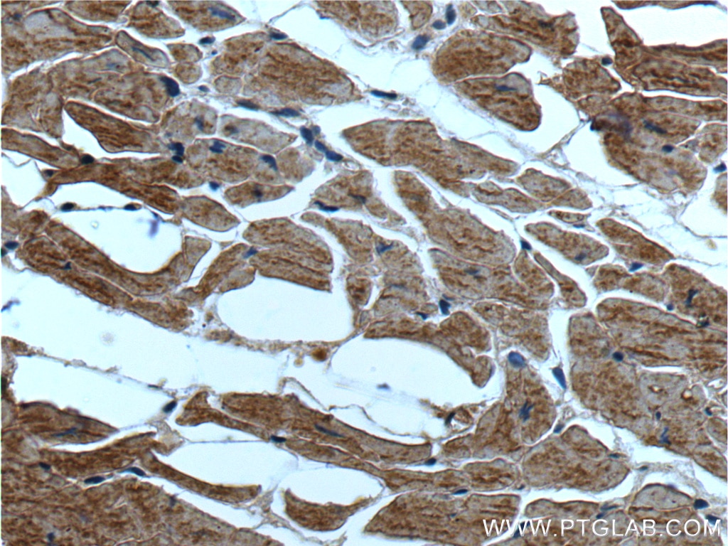 IHC staining of human heart using 60112-1-Ig