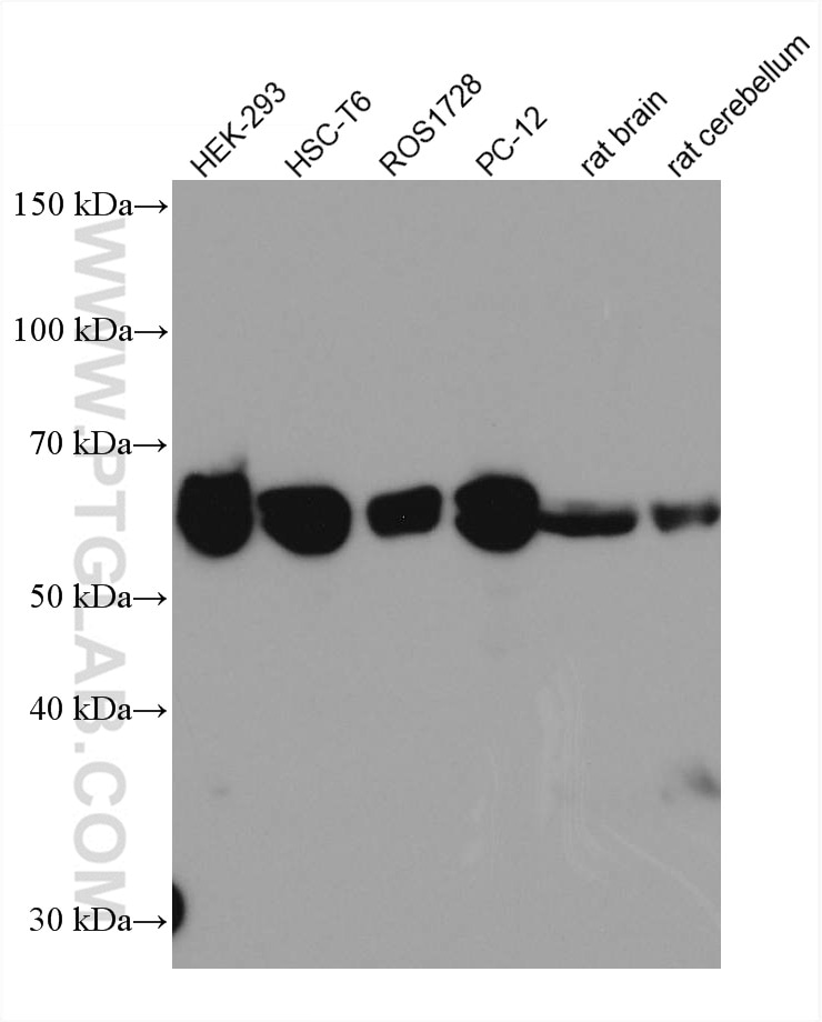 Western Blot (WB) analysis of various lysates using ST2 Monoclonal antibody (60112-1-Ig)