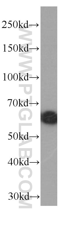Western Blot (WB) analysis of HEK-293 cells using ST2 Monoclonal antibody (60112-1-Ig)