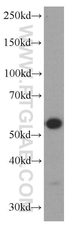 Western Blot (WB) analysis of fetal human brain tissue using ST2 Monoclonal antibody (60112-1-Ig)