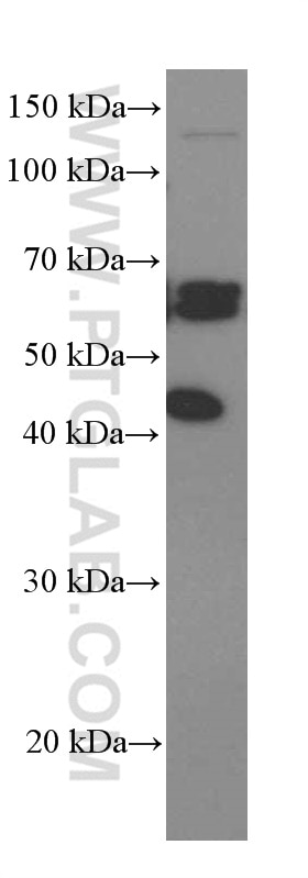 Western Blot (WB) analysis of SGC-7901 cells using ST2 Monoclonal antibody (60112-1-Ig)