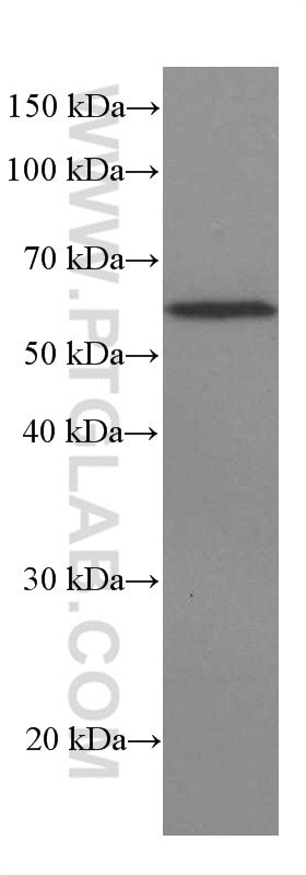 Western Blot (WB) analysis of pig brain tissue using ST2 Monoclonal antibody (60112-1-Ig)