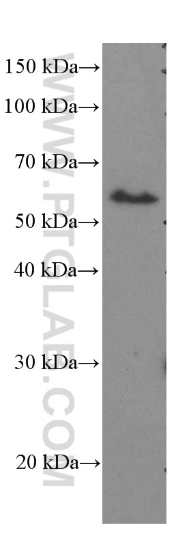 Western Blot (WB) analysis of mouse brain tissue using ST2 Monoclonal antibody (60112-1-Ig)