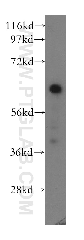 ST2 Monoclonal antibody