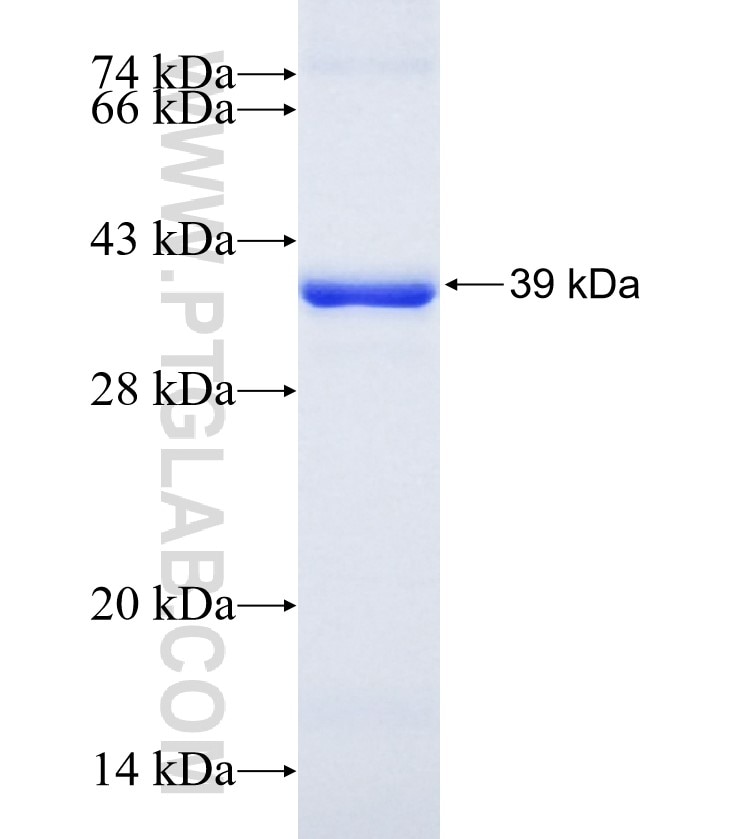 IL-1RL1 fusion protein Ag16656 SDS-PAGE