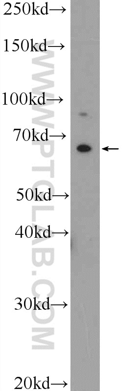 Western Blot (WB) analysis of K-562 cells using IL-1RL2 Polyclonal antibody (25677-1-AP)