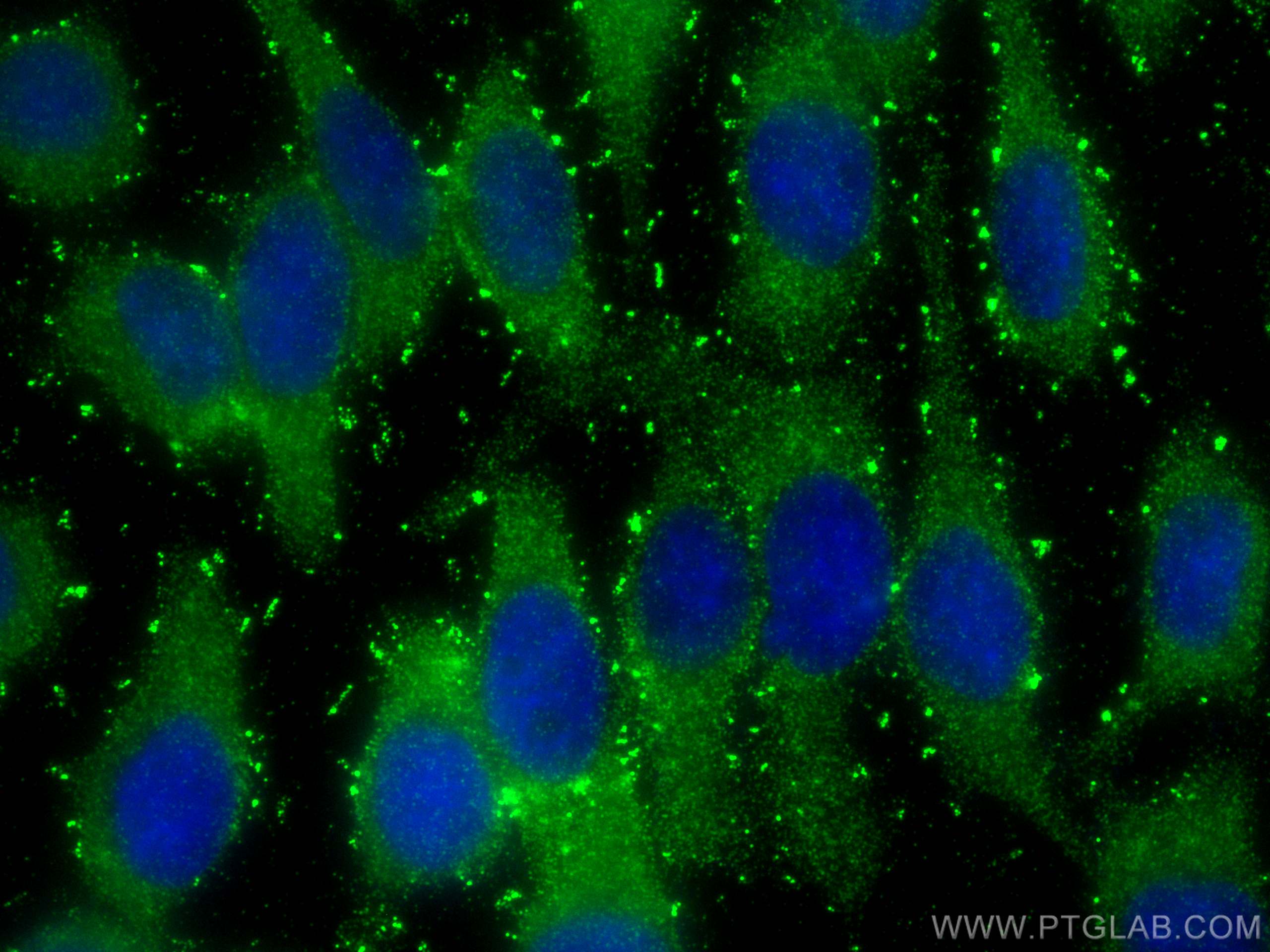 Immunofluorescence (IF) / fluorescent staining of A431 cells using IL-1RA Polyclonal antibody (10844-1-AP)